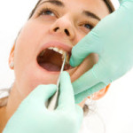 tooth-extraction